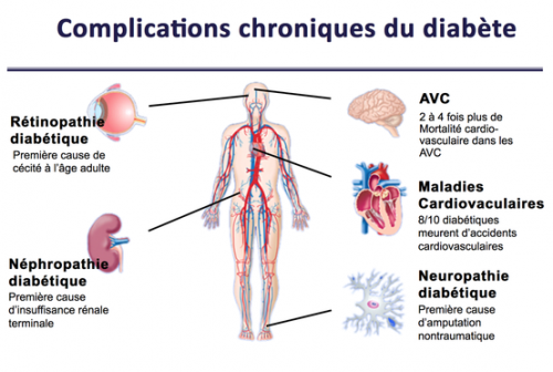 Conseils à mes patients diabétiques pour une meilleure prise en charge