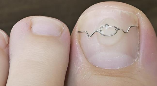 cabinet de podologie cabinet de podologie