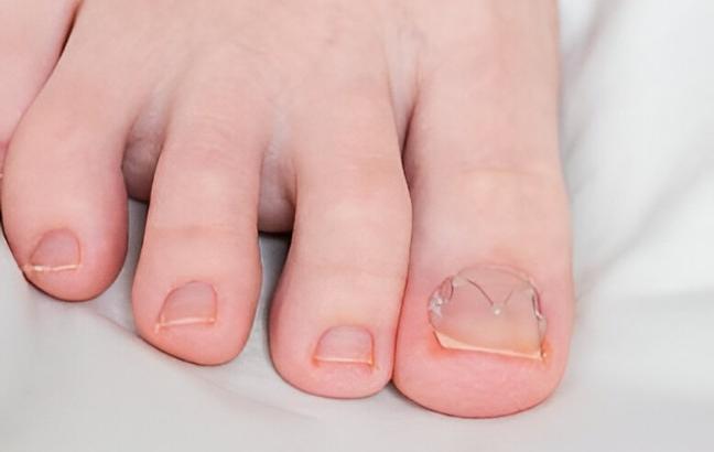 cabinet de podologie cabinet de podologie