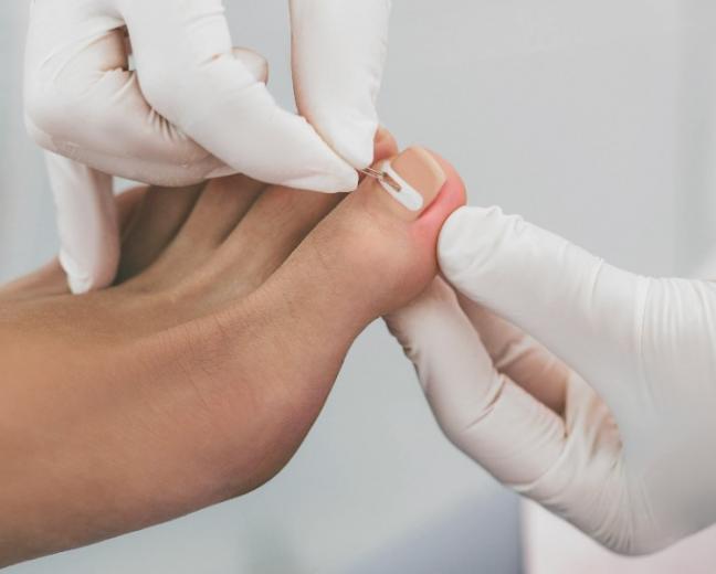 pédicure-podologue près d’Antony pédicure-podologue près d’Antony