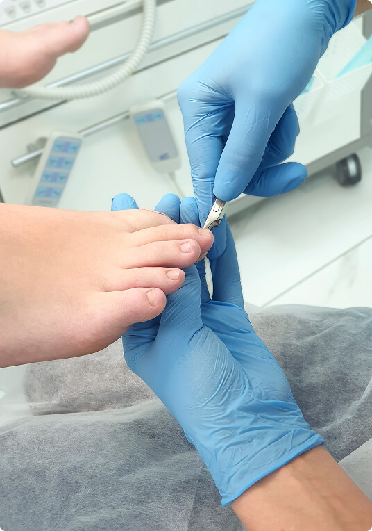 Traitement des mycoses